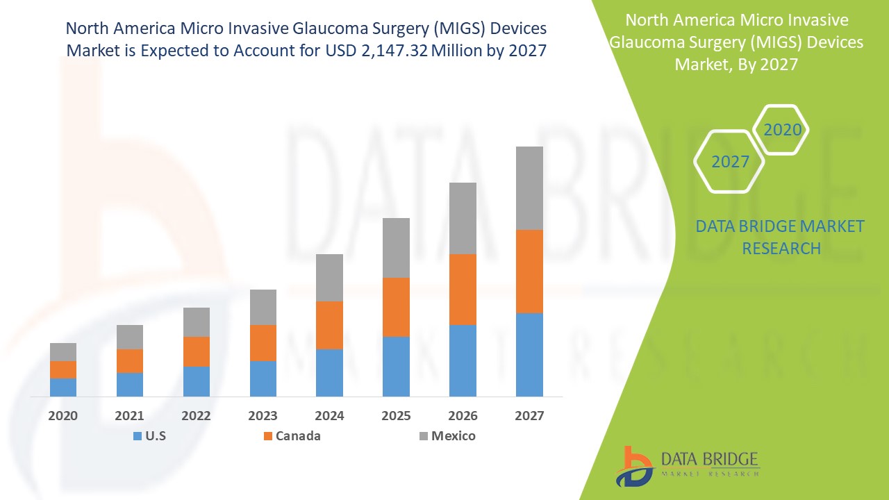 North America Micro Invasive Glaucoma Surgery (MIGS) Devices Market