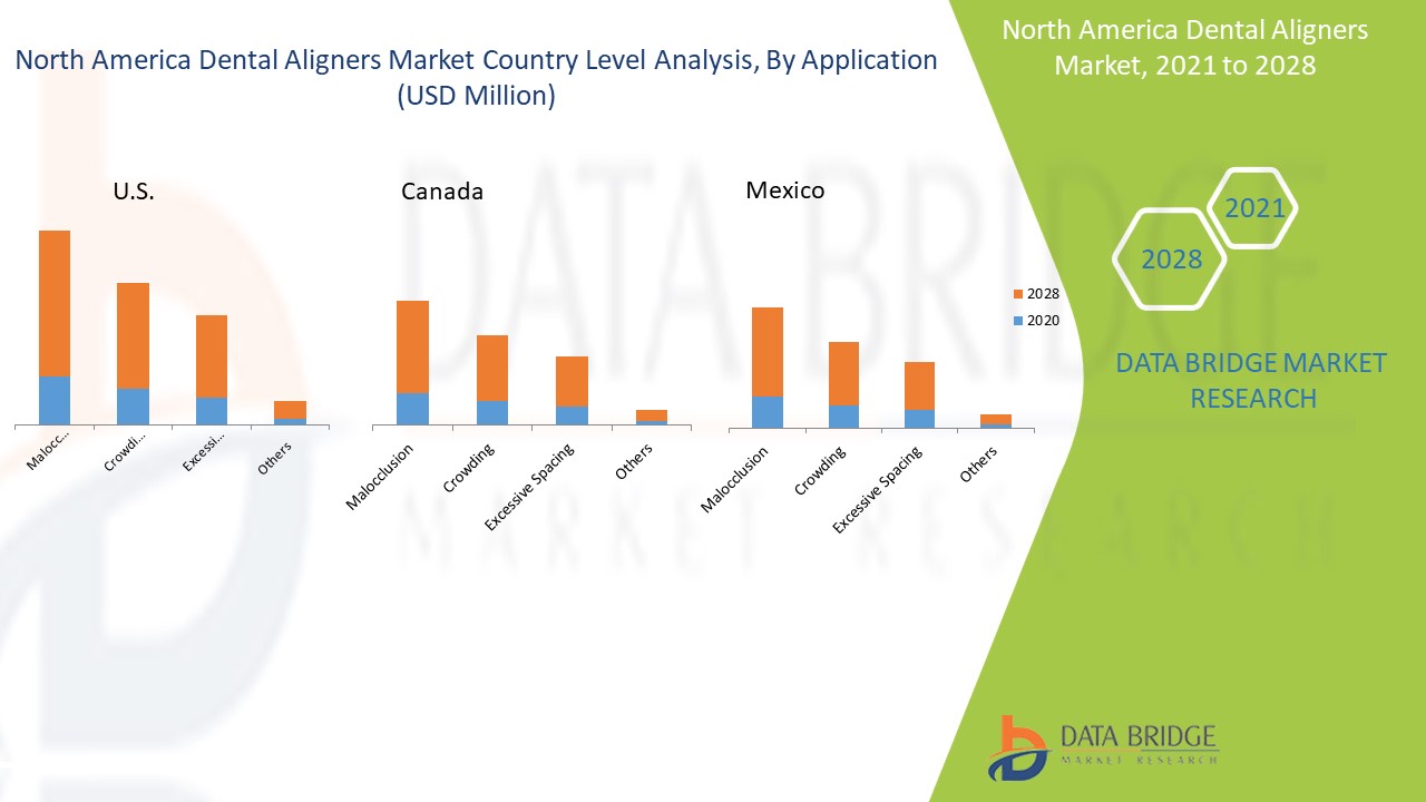 North America Dental Aligners Market