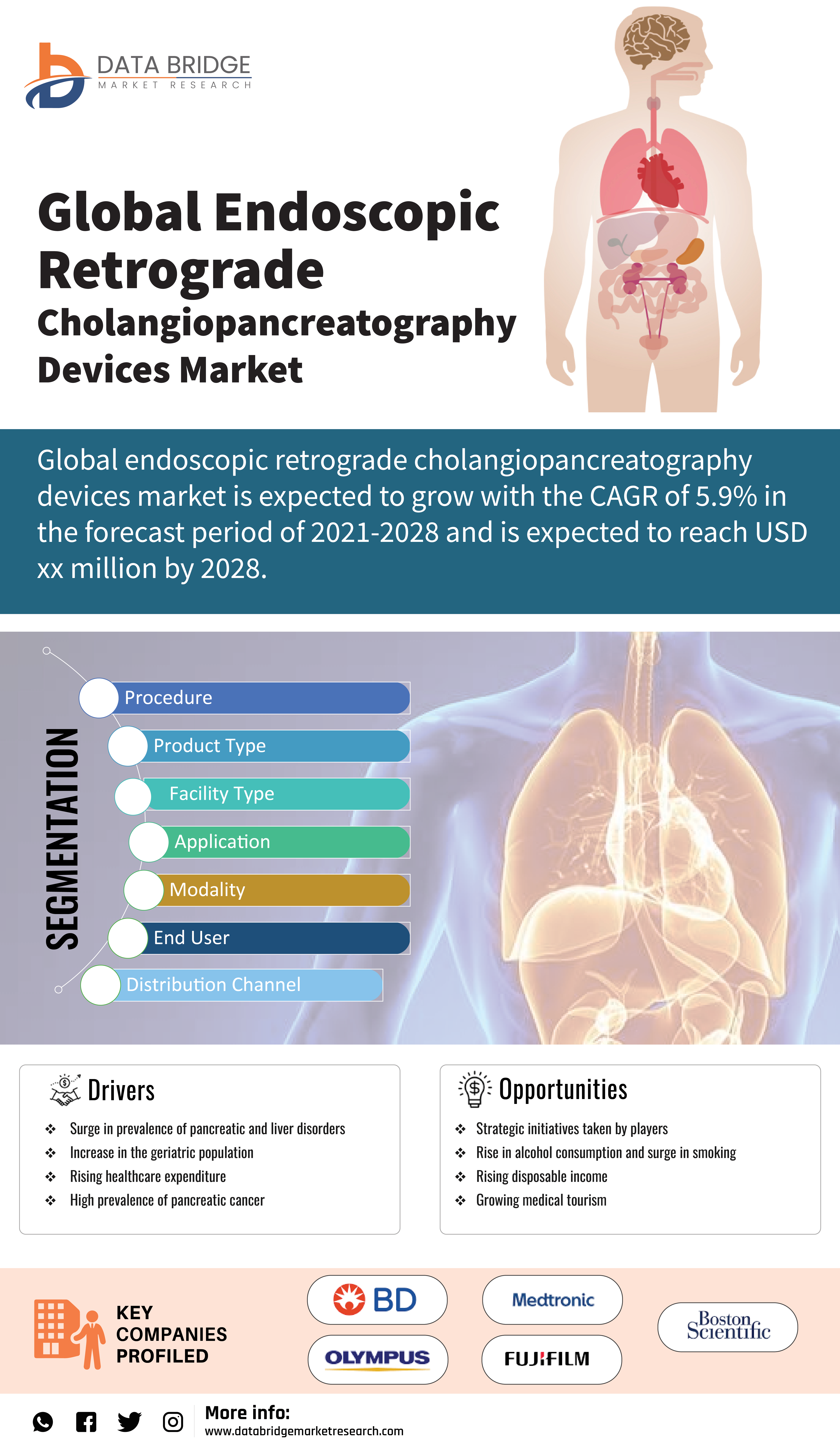 Endoscopic Retrograde Cholangiopancreatography Devices Market