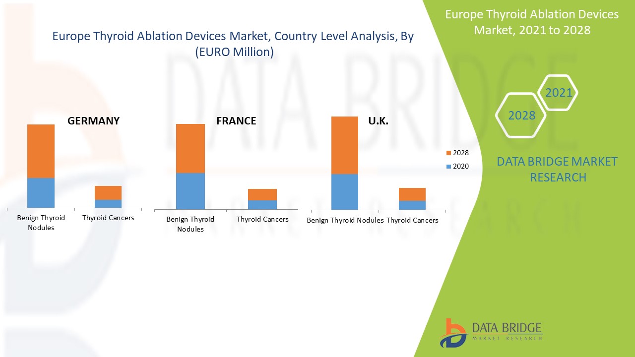 Europe Thyroid Ablation Devices Market