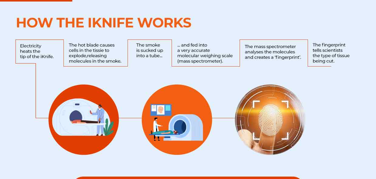 iKnife: A New Device Against Cancer