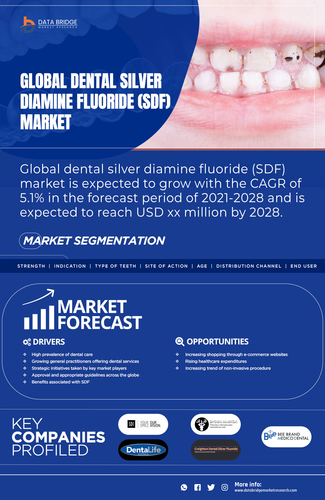 Dental Silver Diamine Fluoride (SDF) Market